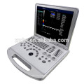 Ultra-sonografia abdominal de doppler da cor 3D betterh do ultra-som do sonoscape